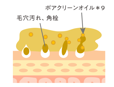 ポアクリーンオイル